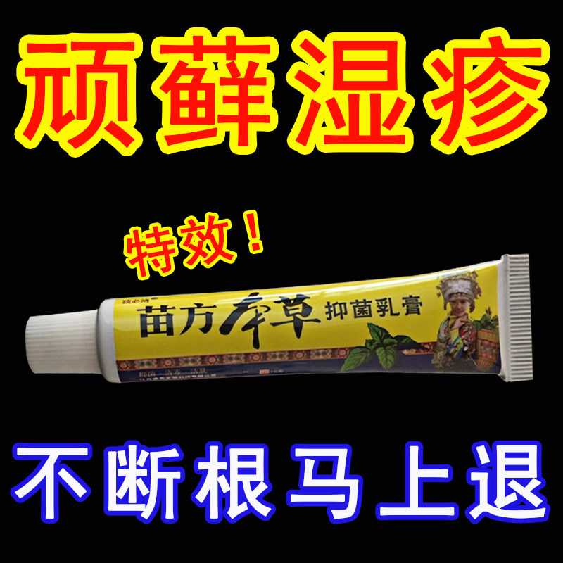 Psoriasis Silver Scrum Eczema Dermatology Special Treatment Stop Itching To Root Scalp Itching External Ringworm T Effective Medicine Cream