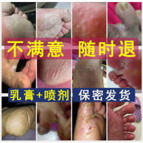 The beriberi root artifact itching peeling sterilization medicine spray treatment of rotten feet foot water itching foot Smelly Foot