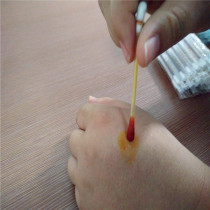 Iodophor disinfection cotton swab iodine wine cotton swab outdoor emergency iodine pen disinfection and sterilization wound cleaning 1 price