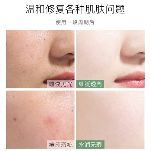 Увлажняющий летний тонер для жирной кожи, влажный освежающий лосьон для ухода за кожей, сужает поры