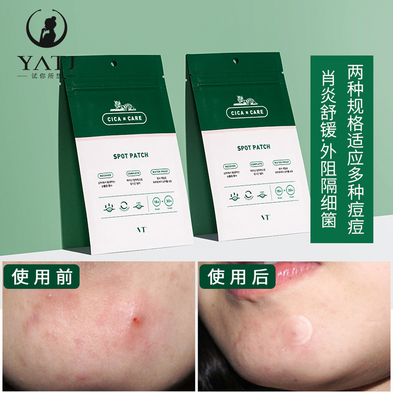 South Korea VT Tiger Invisible Acne Paste 48 Cella asiatica Repairs Acne Closed Acne Calm and Soothes Skin
