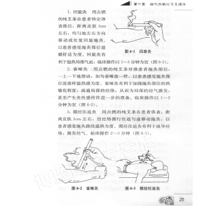 正版 腧穴热敏化 艾灸新疗法 陈日新 内源性热敏调控新途径 提高艾灸疗效新疗法 中医家庭保健养生书 人民卫生出版社