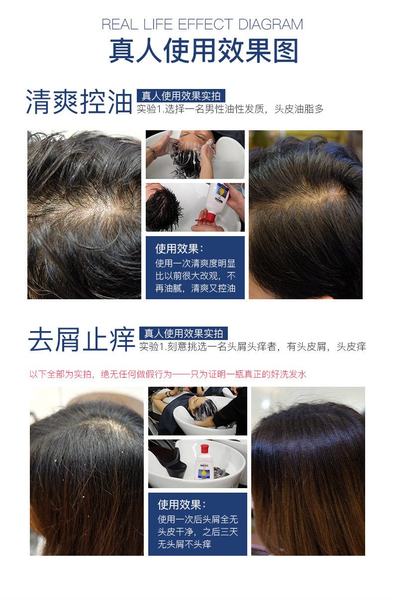 采乐 强劲去屑止痒洗发水 日本花王原料 200ml 图10
