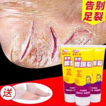 Heavy heel crack fissure and moisturizing cream and cream crack after the foot crack and the heel to peel the skin to crack