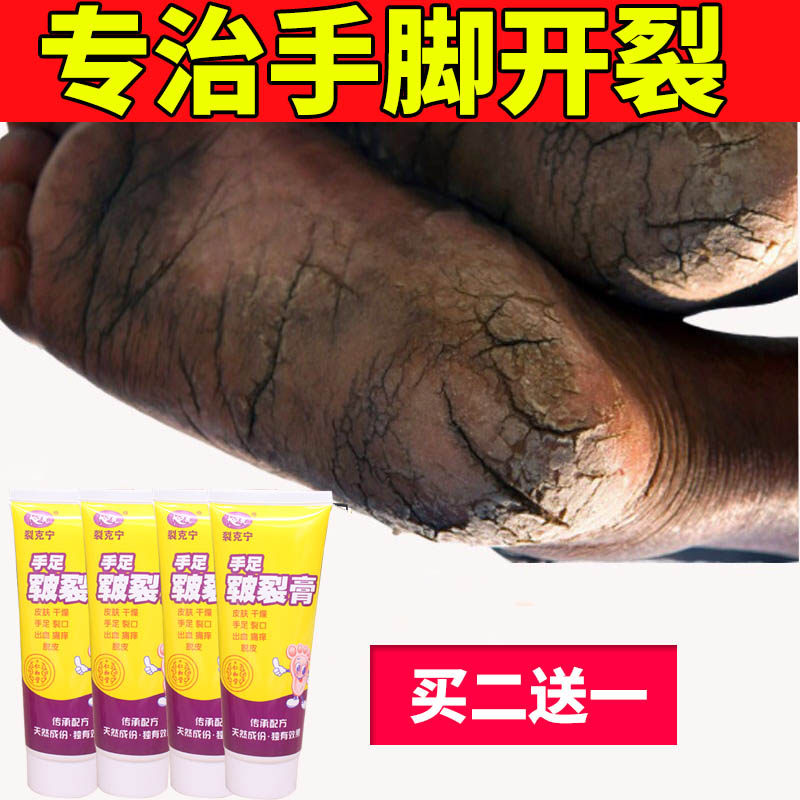 Hand crack foot crack cream heel dry crack repair cream tortoise crack anti crack guard hand and foot horse oil ointment healing cream artifact