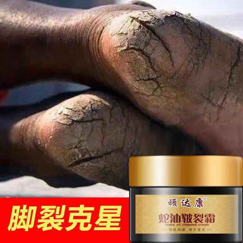 Naughty Snake Oil Rhagra Cream Hands and feet Rift heel Cracked Buy 2 Send 1