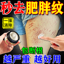 Obesity Line Repair Cream Eliminates Obesity Lines Growth Lines Eliminates Students Thighs Waist and Abdomen Obesity Lines Removal Cream