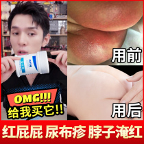 Kala baby baby newborn red butt butt cream Music special red butt artifact butt cream official flagship store