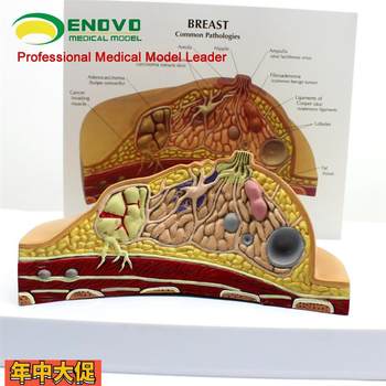 Yino genuine breast pathological anatomy model breast model obstetrics and gynecology teaching nursing breast model