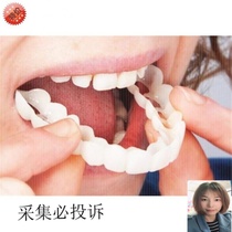 Denture cover simulation to cover teeth Self-repair Self-made temporary filling of front teeth filling model whitening repair silicone missing teeth