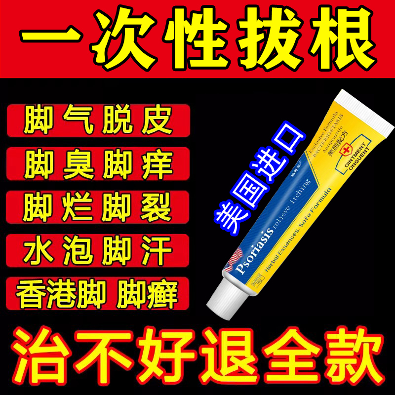 Anti-Itch Foot Cream, Anti-Bacterial, Anti-Fungal, for Peeling Skin, Foot Sores, Blisters, and Fungus
