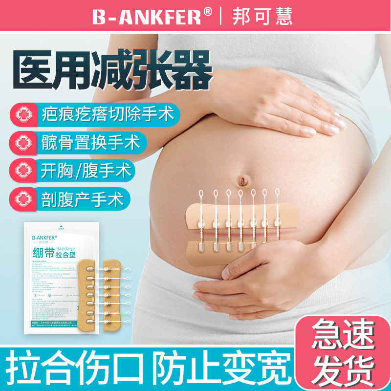 医用减张器剖腹产术后伤口免缝合皮肤疤痕手术刨腹产甲状腺减张贴