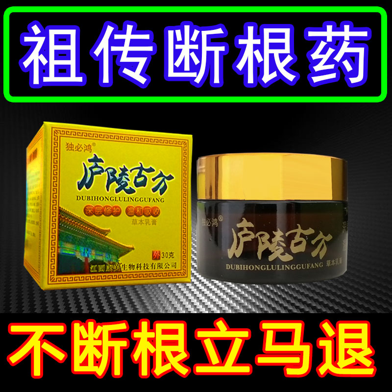 Psoriasis, psoriasis, eczema, skin disease, special treatment, antipruritic, scalp itching, external use, tinea moss special ointment