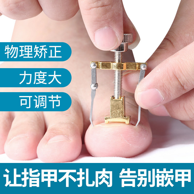 Nail supporter special nail groove ingrown nail supporter toenail supporter toenail long meat corrector