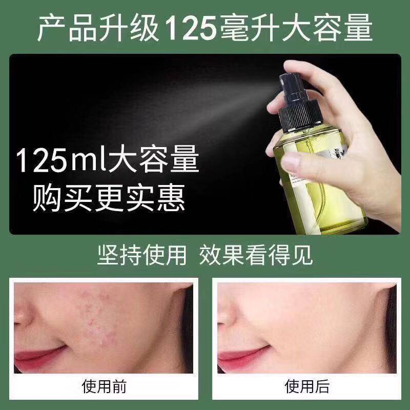 Snow buds have a taste of verbena ketone rosemary pure plant grass scent toning cleansing and tightening pores hydrate