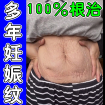 Stretch Marks Repair Cream Stretch Marks Postpartum Elimination Stretch Marks Firming Belly Repair Cream Prevents Obesity Growth Marks