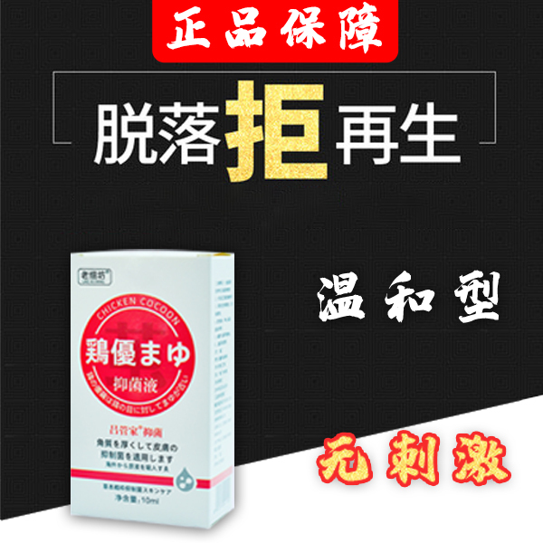Mr. Lu's Special Foot Callus Remover Is Gentle and Non-Irritating, Ensuring No Peeling Off. Authentic Product Guarantee. Jiangxi Zhou Lu Butler