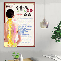 Traditional Chinese Medicine Health Preservation Gallery Decoration Painting Custom Spine Related Diseases Wall Chart Spine Full Picture Publicity Advertising Poster