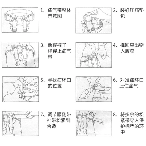 Jianzhijia ai beizer hernia зафиксирована с младенцами и маленькими детьми, детский пах грыж, дети выпуклые пупок