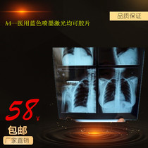 A4 -- Medical blue inkjet laser can film CR DR film CT film X-ray PET waterproof blue sheet