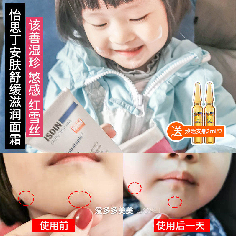 Spot Repair Skin Barrier Spain ISDIN Infant Cream Rash Cream Sensitive Baby Pregnant Women