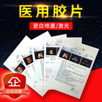 Medical film A4 porcelain white inkjet color ultrasound B-ultrasound gastrointestinal endoscopy PET translucent laser film printing paper 100 sheets