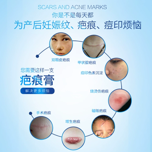 金芭克 Снятие крема для удаления рубца сбоя