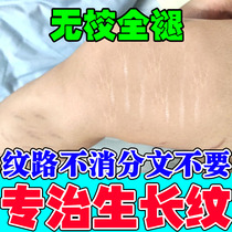 Obesity mark repair cream growth mark removal student thigh fade stretch mark butt firming cream removal for men