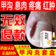 Special medicine for treating onychomycosis of fingernails, genuine radical cure artifact, anti-inflammatory external medicine and sterilizing liquid for toes