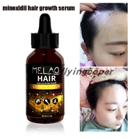 minoxidil hair growth serum