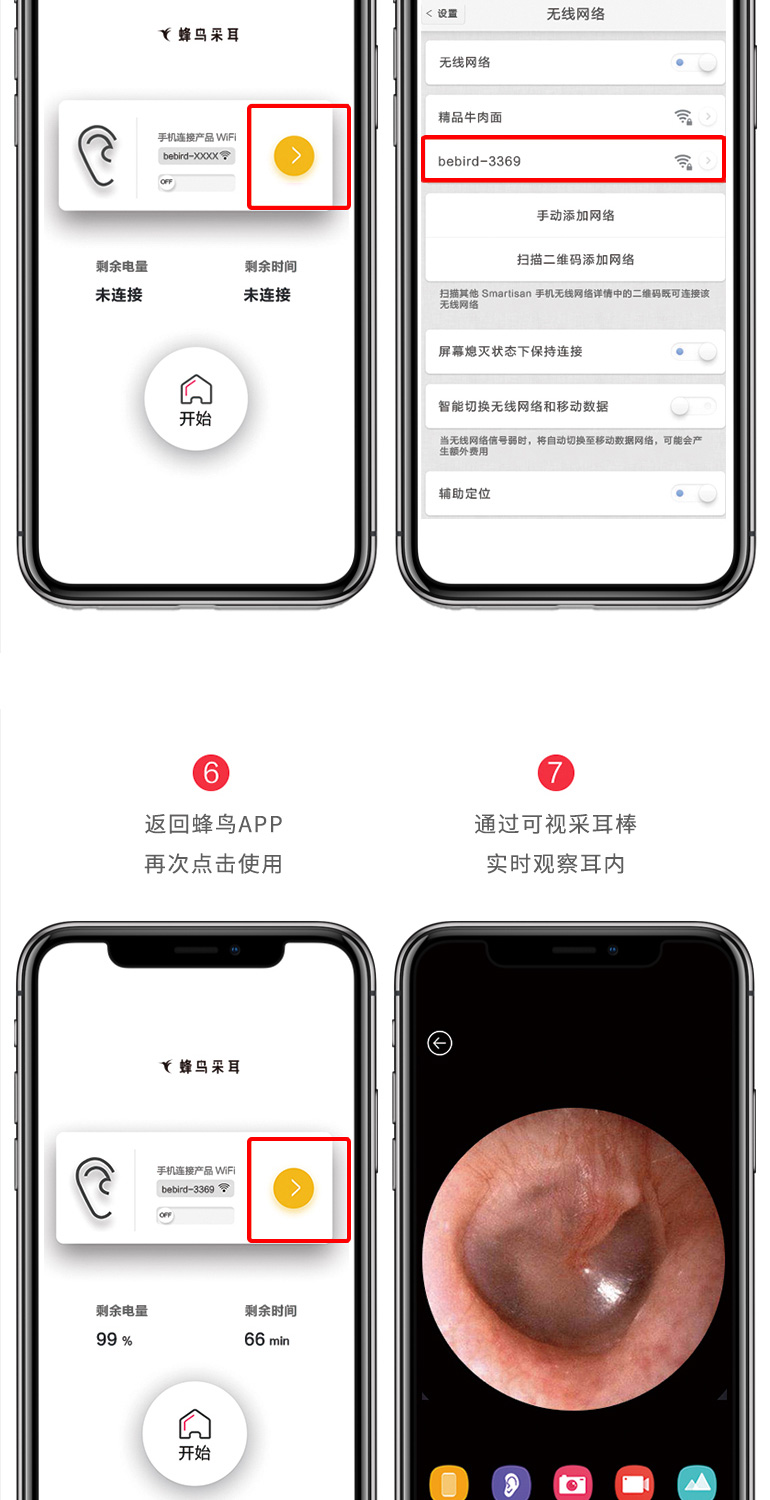 蜂鸟 高清可视挖耳勺 无线连接手机 3轴陀螺仪防眩晕 图28