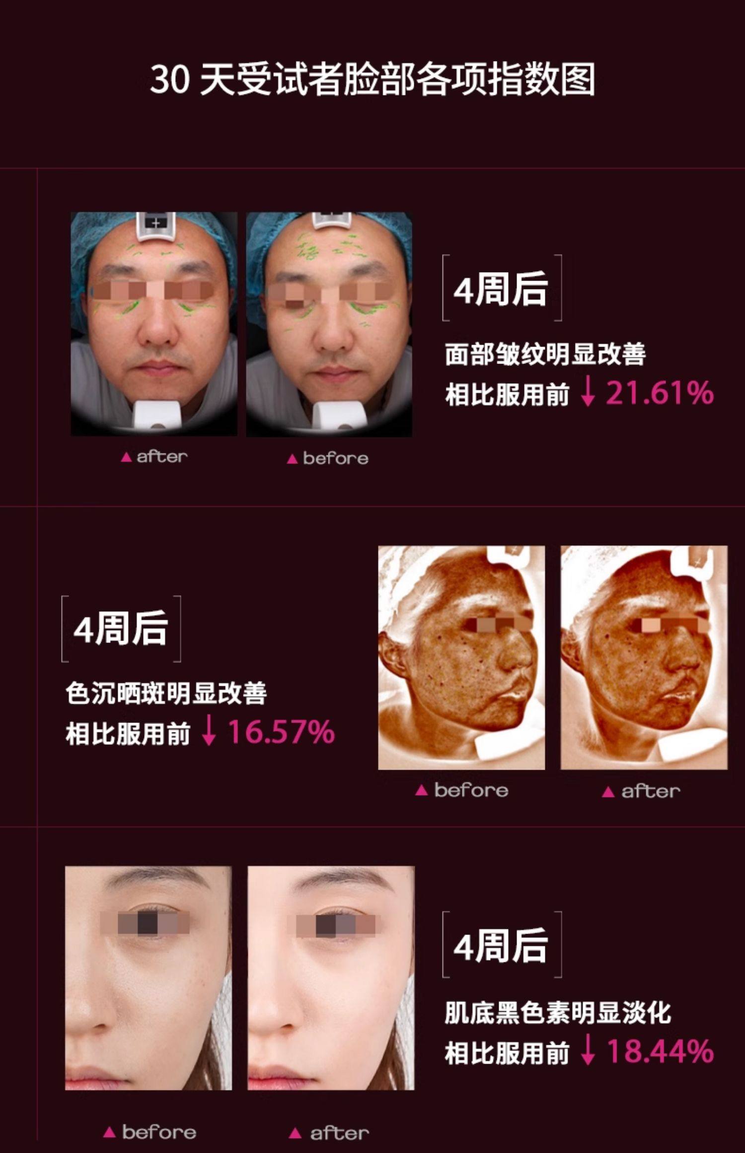 【中国直邮】 莱特维健 冰肌颜egt99.99%手性纯度L麦角硫因口服时光胶囊美亮白 60粒/盒