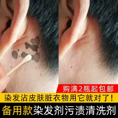 Hair Dyeing Cleansing Emulsion Removal of Dyeing Plaster Skin Clothes No Residual Cleaning Agent