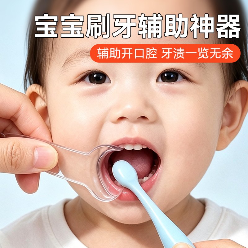 Baby Tooth Brushing Tool! Children's Oral Opener to Assist with Brushing, Tooth Stain Cleaning Gadget Baby Tooth Brushing Tool! Children's Oral Opener to Assist with Brushing, Tooth Stain Cleaning Gadget