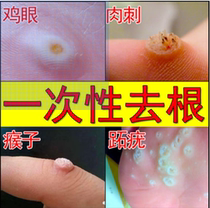 Chicken eye patch Baiyunshan toe spirit ointment hand paste to the doctor non root removal paste Tongrentang winger meat Thorn