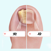 Xiaohongshu recommends a drop a drop and a new hand and foot (buy three get two free buy five get five free)