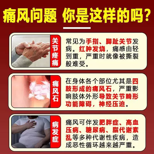 Японская кремовая наклейка подагка мочевая кислота с высоким уровнем кристаллической красной набухание боль в суставах продемонстрировала отек и холодный компресс