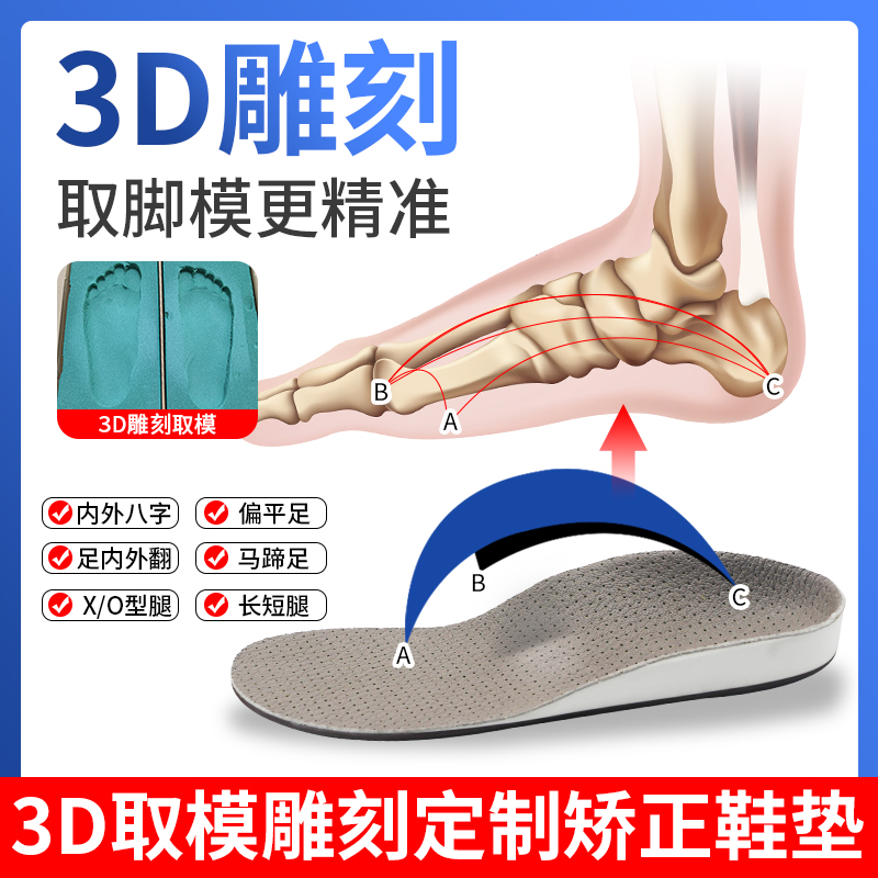 Hiking foot film customized flat foot correction inner mat of eight words of child foot foot outer tumble male long short XO leg foot foot cushion