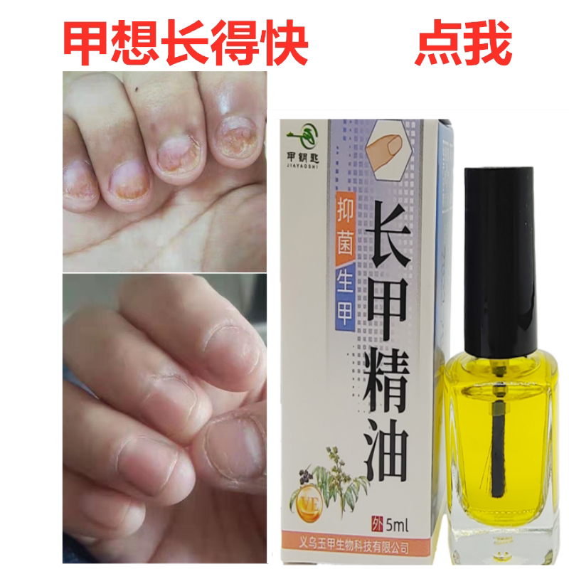 Nail Growth Liquid, Nutritional Oil, Nail Growth Essential Oil, Accelerates Growth, Repairs Damaged Nails, Antibacterial Liquid, Nail Protection Oil