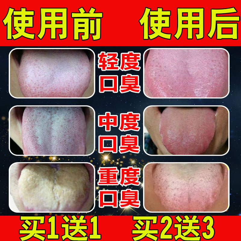 Remove bitter mouth and bad breath health care stickers clear stomach fire dry mouth dry tongue thick white tongue conditioning dampness stickers with cracks and tooth marks