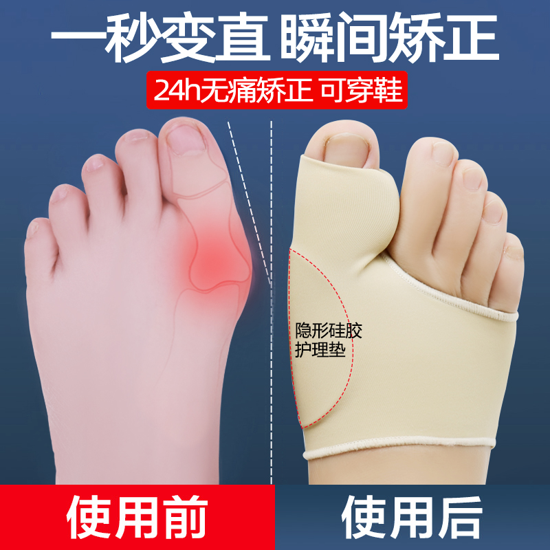 Big female toe thumb valgus corrector can wear shoes, women, men and women to correct the big foot bone separation toe splitter