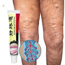 Crema para el tratamiento de venas varicosas pomada para el