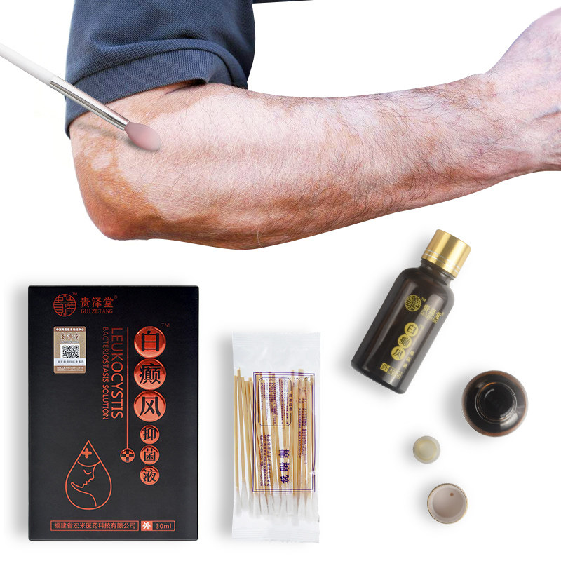 Guizetang Vitiligo antibacterial liquid white spot skin net sweat spot psoralen tincture nemesis melanin external use
