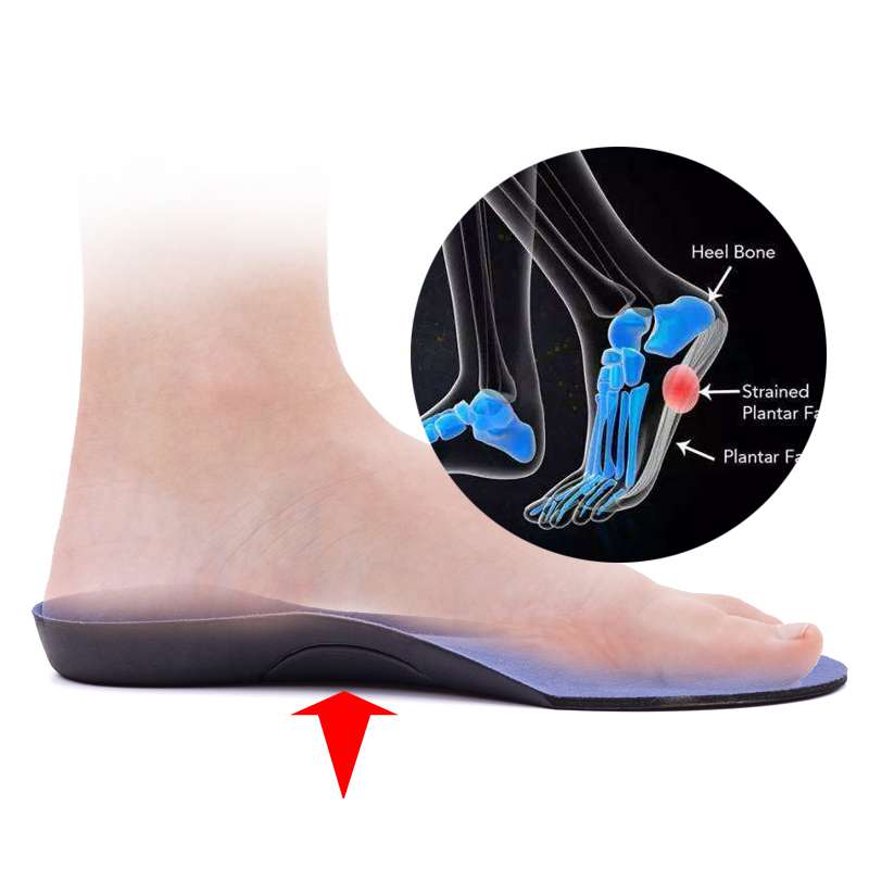 Partial Flat Foot Correction Insole Flat Foot Foot Cushion Plantar plantar XO type leg Correction Foot Boat Bones Orthopaedic