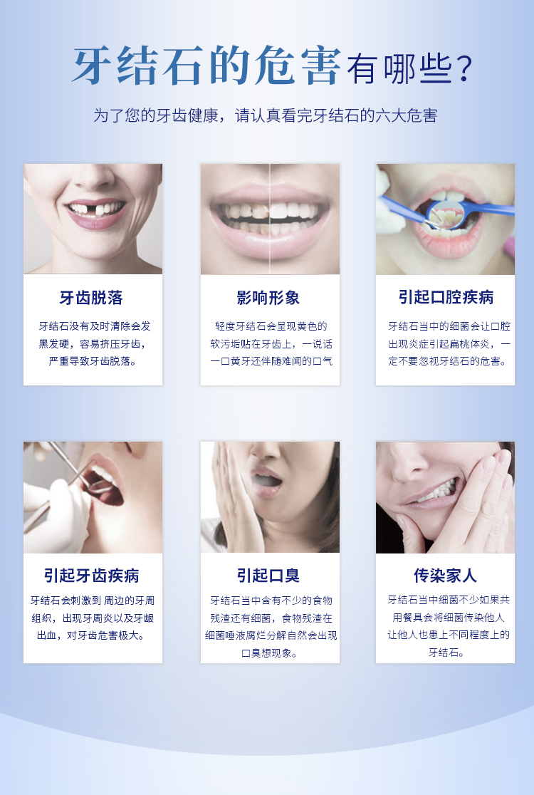 韩国进口 麦迪安 牙石护理 清洁牙膏 120g*3支 图3