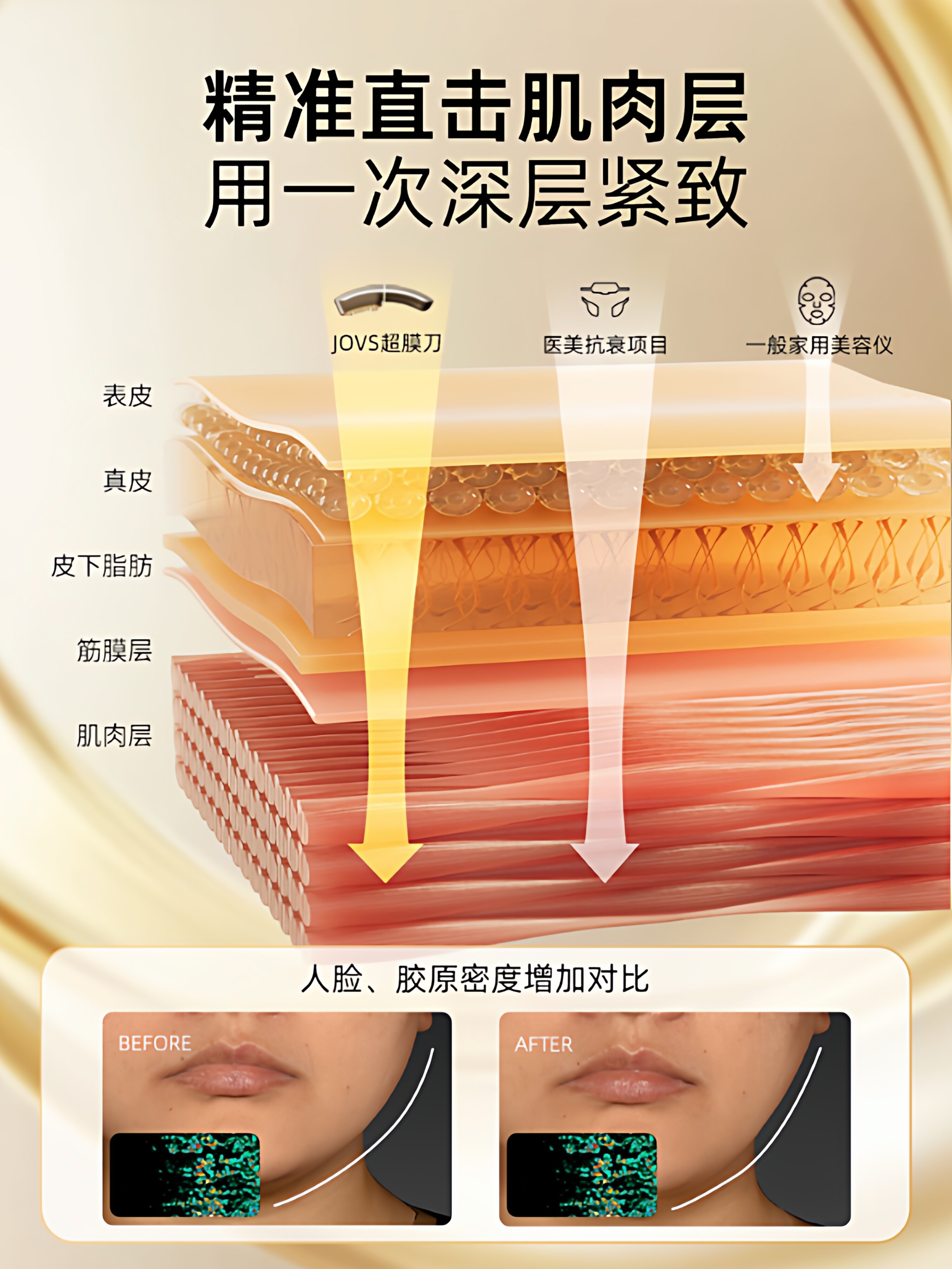 [Same Model as Zhong Liti] Jovs Ultra Membrane Knife Small V Face Device for Facial Lifting and Firming, Home Anti-Aging Beauty Instrument