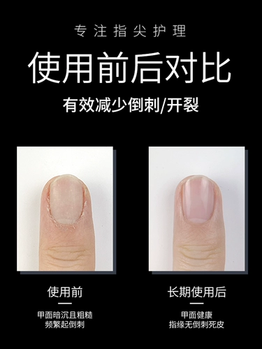 Питательное масло для ногтей, масло для пальцев, лечебный отшелушивающий питательный гель-лак для маникюра