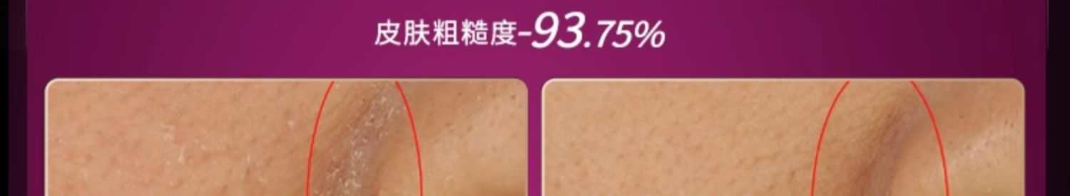 维莉/Wennil小魔盒水养光肤仪I3 wennil维莉小气泡