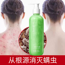  In addition to mites shower gel to remove acne Back acne sterilization to remove mites whole body itching back men and women to remove mites and acne