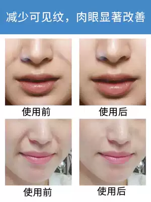 Fa Ling pattern stickers official flagship store face wrinkle artifact to eliminate thin lines small iron to buy